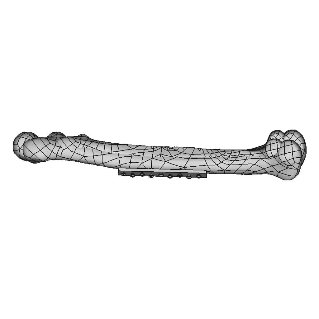 Femur Bone With Zk60 Plate - Standard Mechanical Component_270_0_degree_snapshot