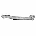 Femur Bone With Zk60 Plate - Standard Mechanical Component_270_0_degree_snapshot