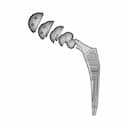 Hip Implant - Orthopedic - Downloadable CAD Representation_270_0_degree_snapshot