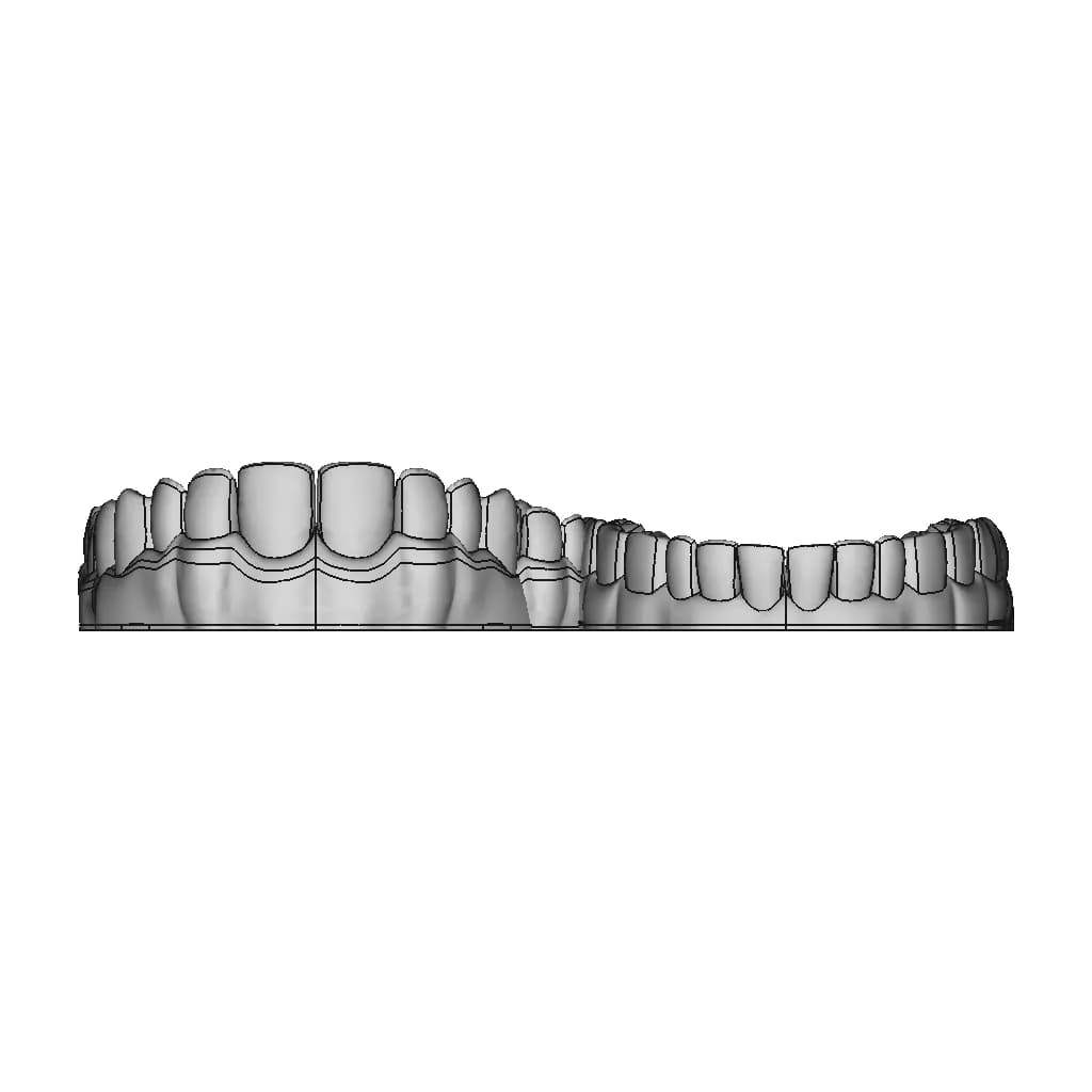 Upper Jaw Teeth / Alt Üst Çene Diş Dental - Dent - Standard Mechanical Component_0_0_degree_snapshot