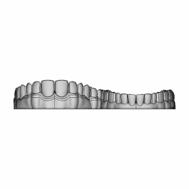 Upper Jaw Teeth / Alt Üst Çene Diş Dental - Dent - Standard Mechanical Component