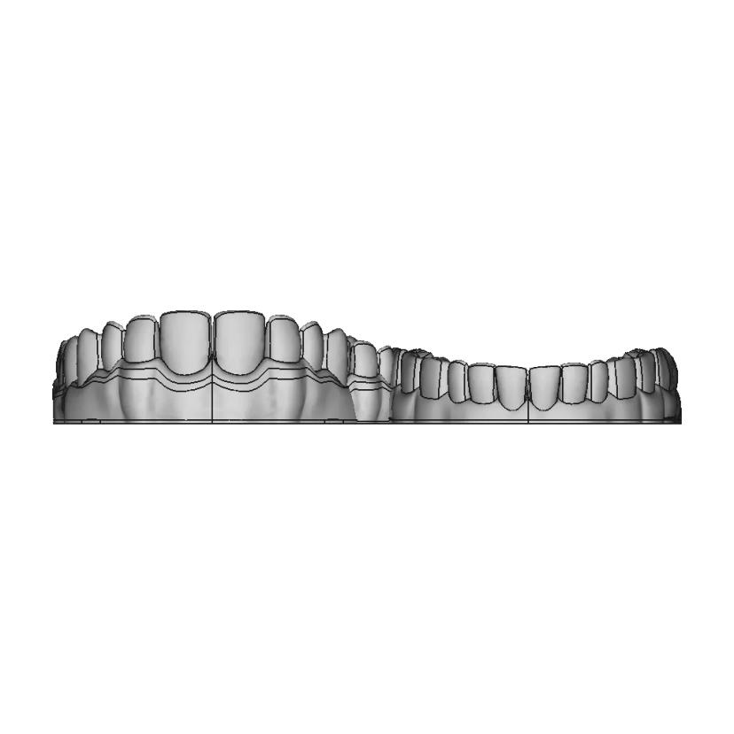 Upper Jaw Teeth / Alt Üst Çene Diş Dental - Dent - Standard Mechanical Component