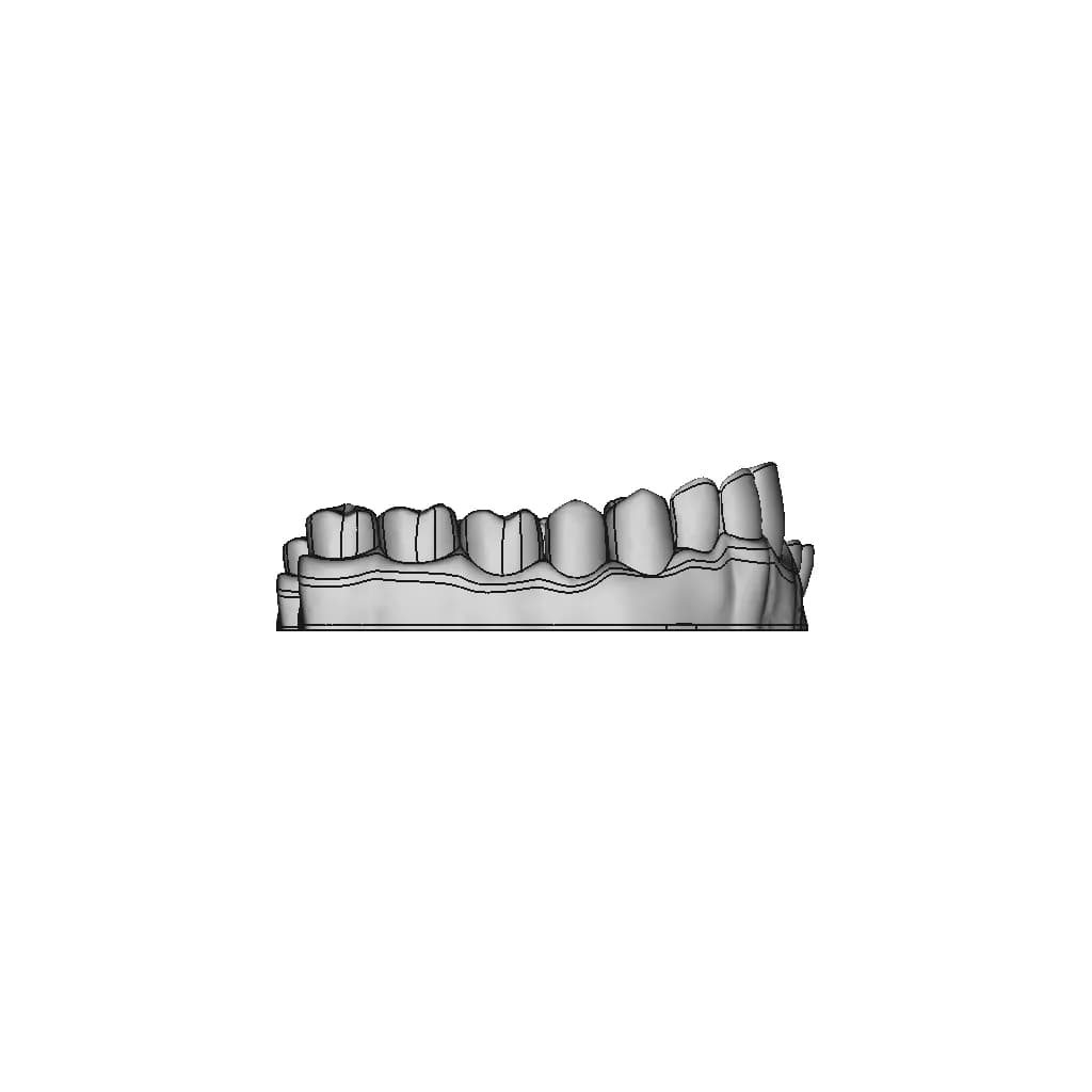 Upper Jaw Teeth / Alt Üst Çene Diş Dental - Dent - Standard Mechanical Component_0_270_degree_snapshot