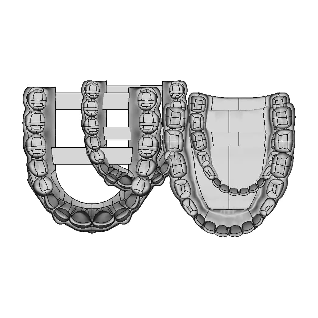 Upper Jaw Teeth / Alt Üst Çene Diş Dental - Dent - Standard Mechanical Component_270_0_degree_snapshot
