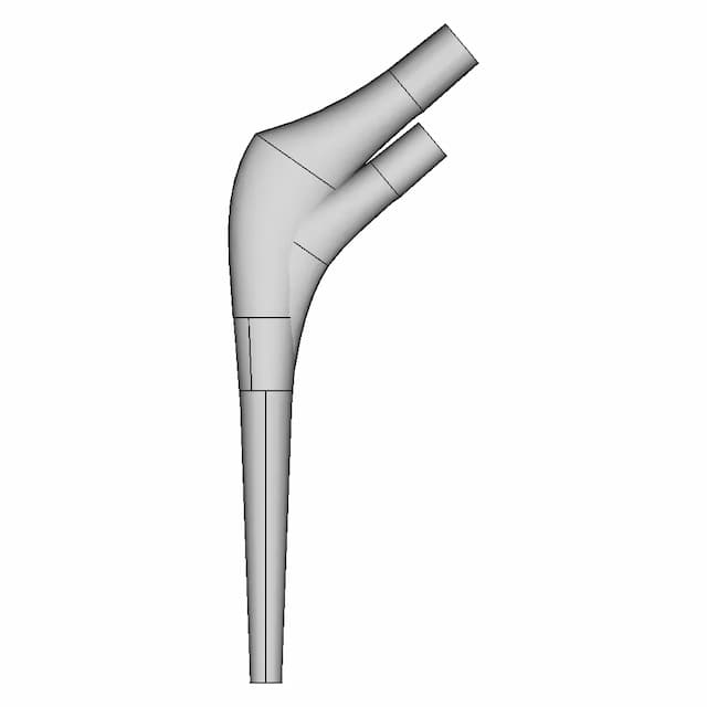 Hip Implants - Stem | 3D Engineering Design File