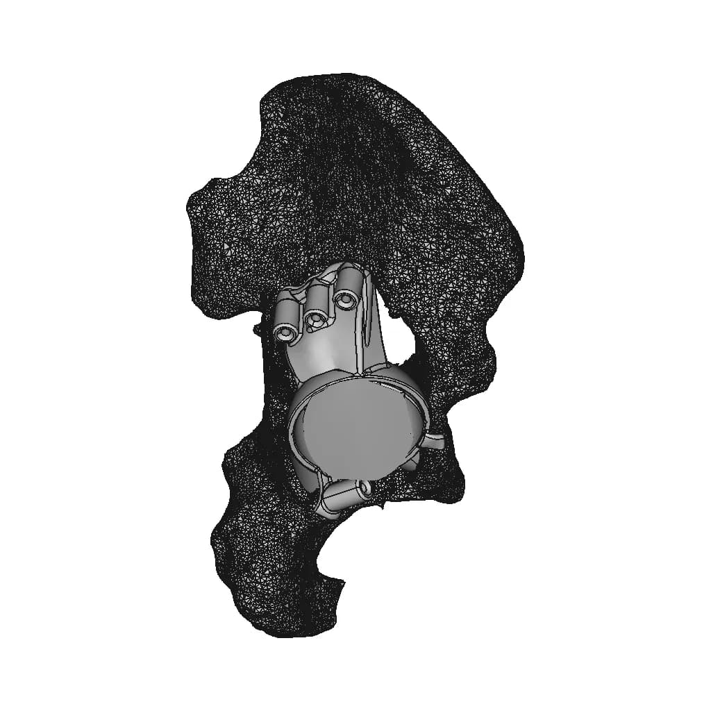 Hip Cavity Implant | 3D Engineering Design File_0_270_degree_snapshot