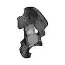 Hip Cavity Implant | 3D Engineering Design File_0_270_degree_snapshot