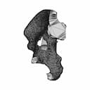 Hip Cavity Implant | 3D Engineering Design File_0_90_degree_snapshot