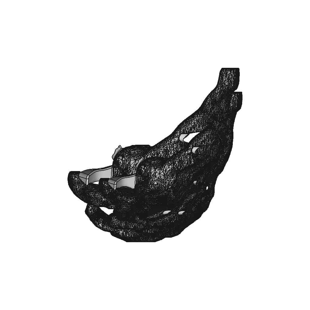 Patient-Specific Shoulder Implant - Standard Mechanical Component_0_270_degree_snapshot