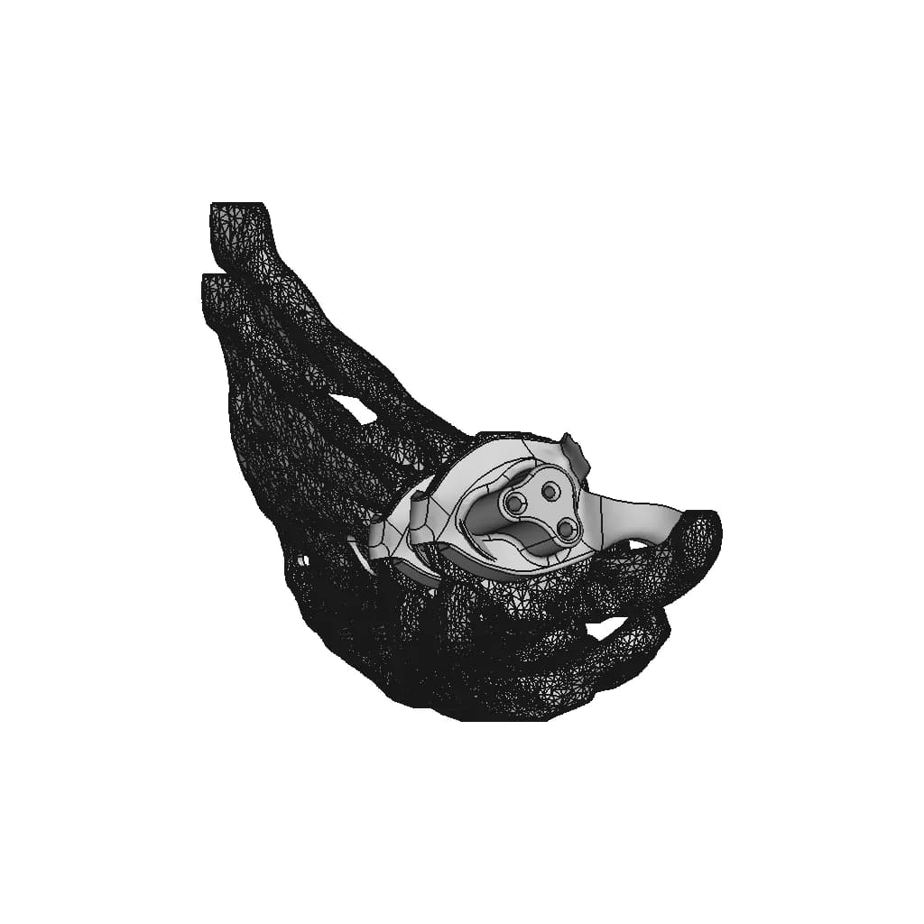 Patient-Specific Shoulder Implant - Standard Mechanical Component_0_90_degree_snapshot