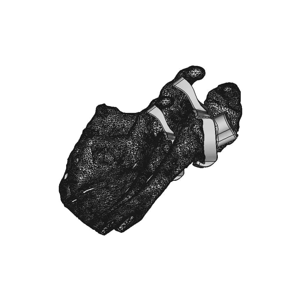 Patient-Specific Shoulder Implant - Standard Mechanical Component_270_0_degree_snapshot