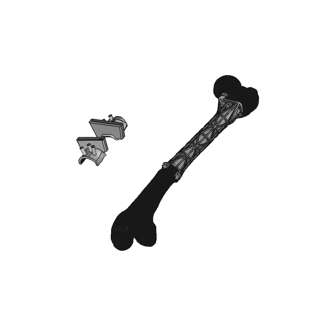 Individual Femoral Implant On The Type Of Truss | 3D Engineering Design File_60_30_degree_snapshot