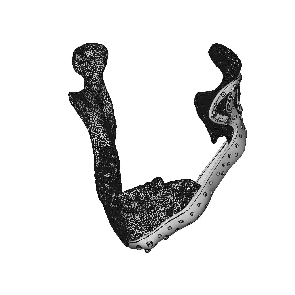 Lower Jaw Prosthesis - Downloadable CAD Representation_60_30_degree_snapshot