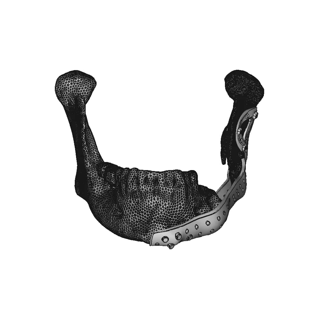 Lower Jaw Prosthesis - Downloadable CAD Representation_90_0_degree_snapshot