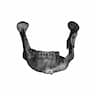 Lower Jaw Prosthesis - Downloadable CAD Representation_90_0_degree_snapshot
