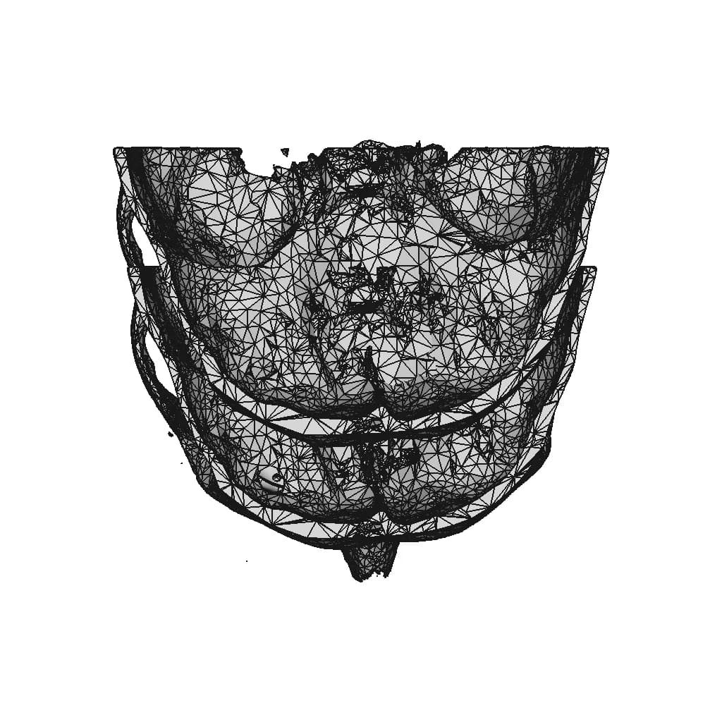 Eye Orbit Prosthetic | High-Quality CAD Model_270_0_degree_snapshot