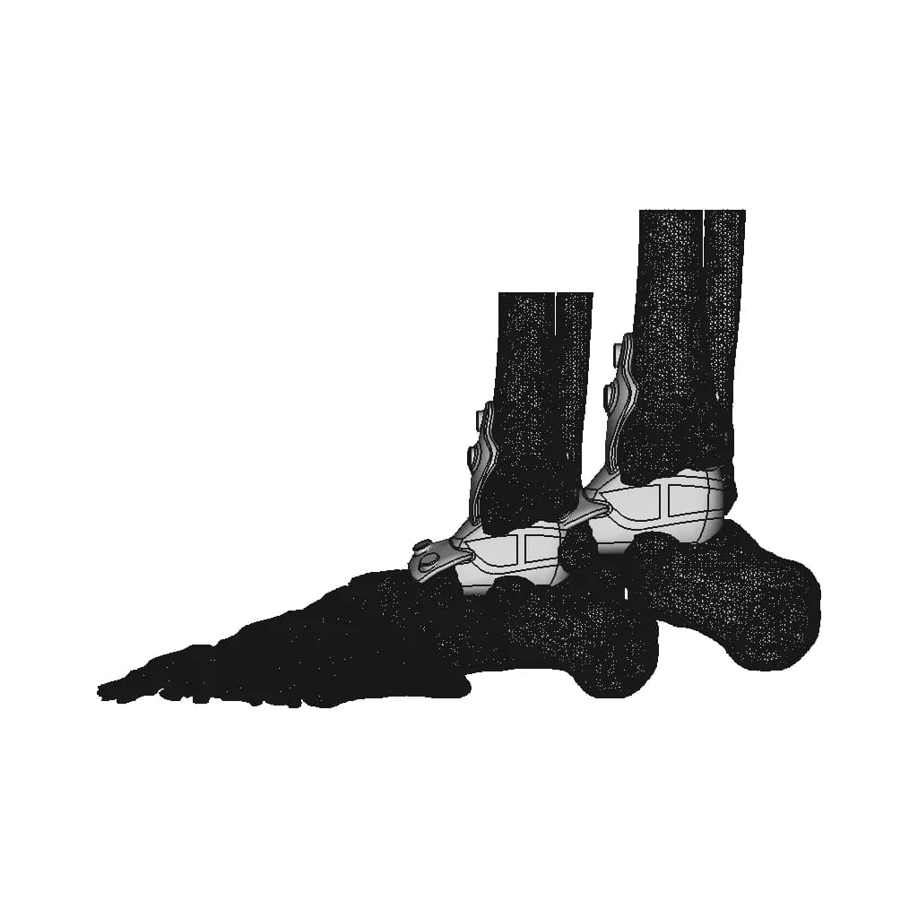 Ankle Implant | 3D Engineering Design File_0_90_degree_snapshot