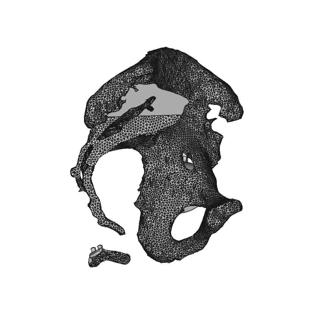 Hip Cavity Implant | 3D Engineering Design File_0_270_degree_snapshot