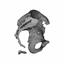 Hip Cavity Implant | 3D Engineering Design File_0_270_degree_snapshot