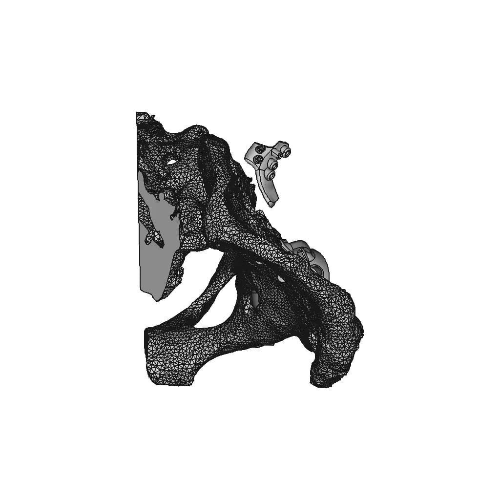 Hip Cavity Implant | 3D Engineering Design File_270_0_degree_snapshot