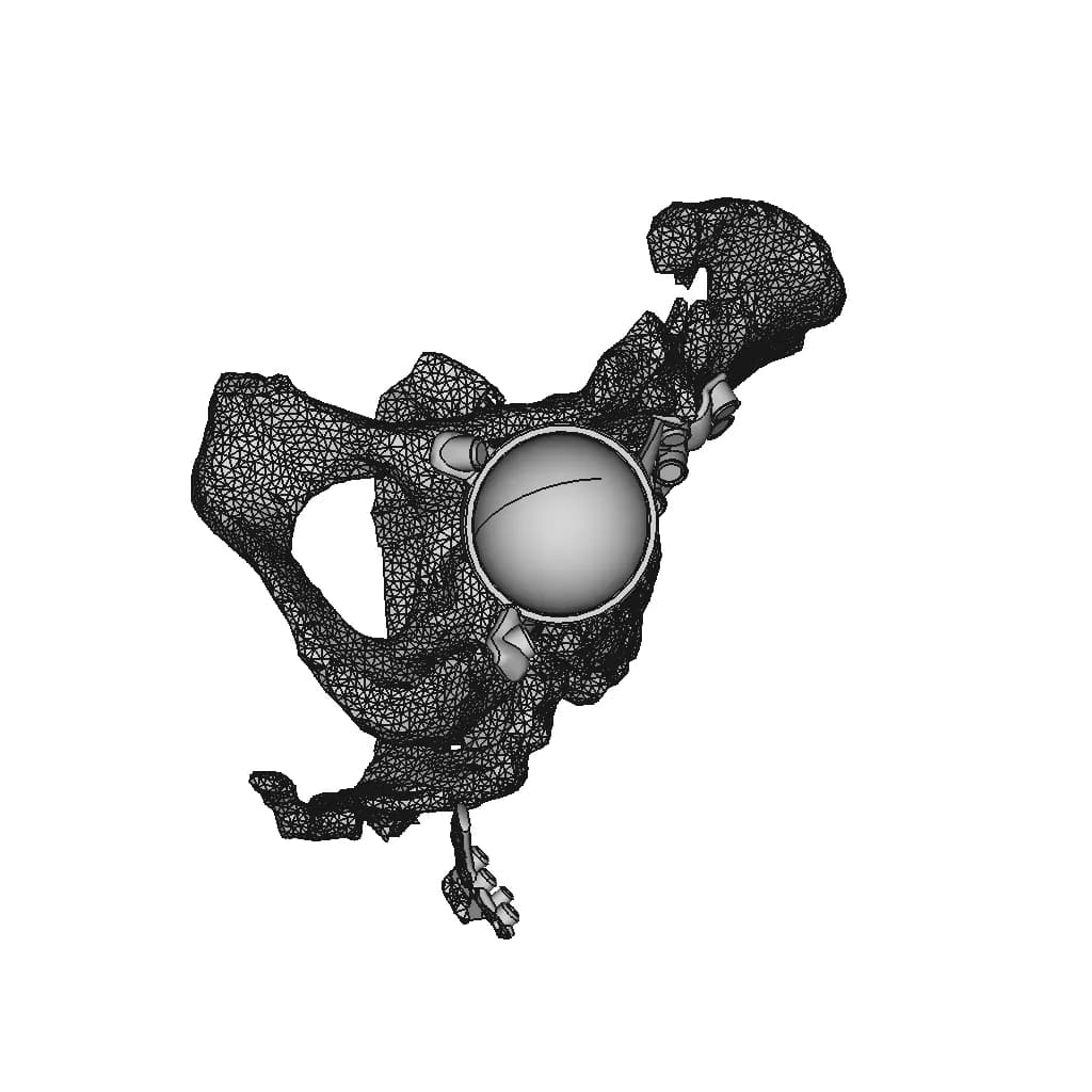 Hip Cavity Implant | 3D Engineering Design File_60_30_degree_snapshot