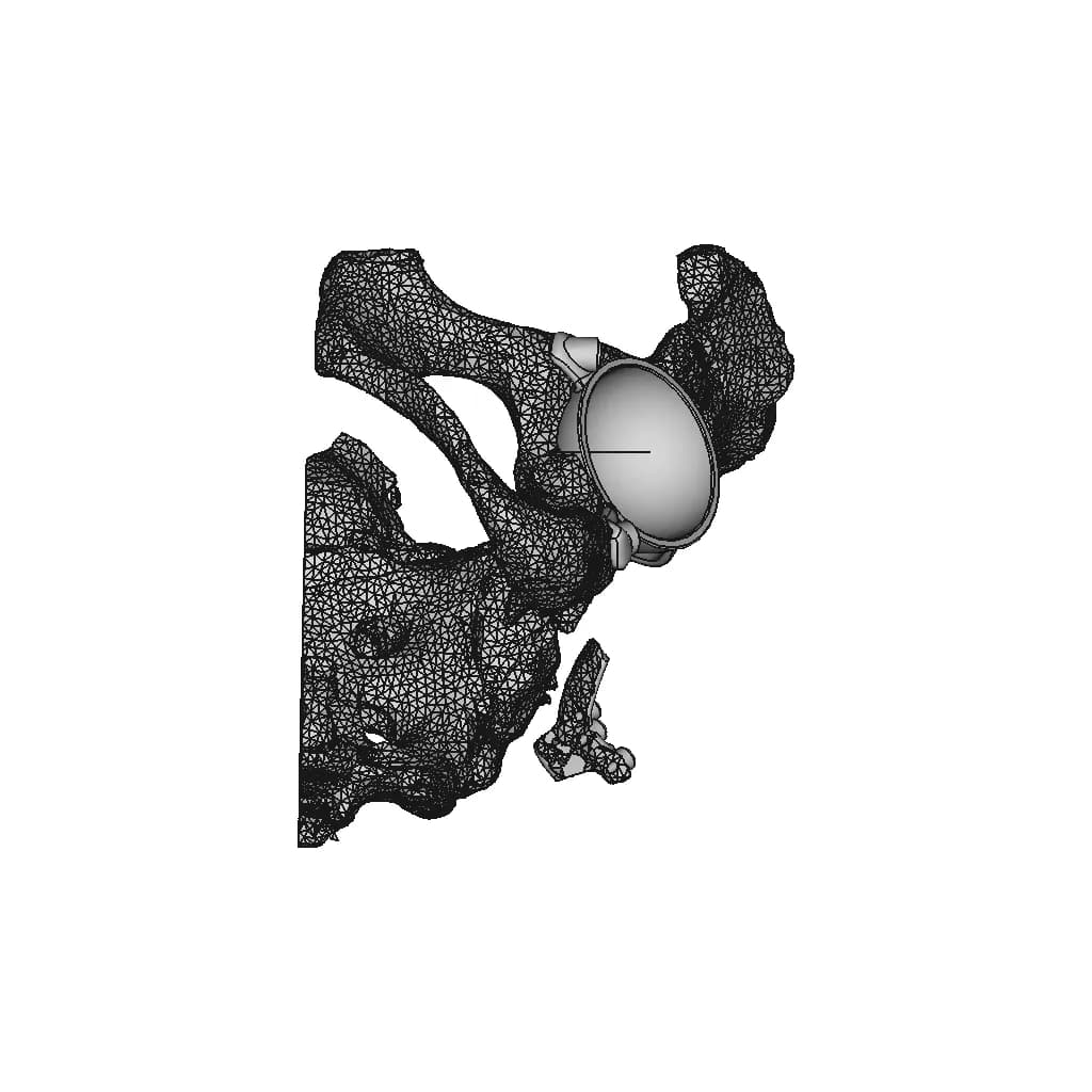 Hip Cavity Implant | 3D Engineering Design File_90_0_degree_snapshot