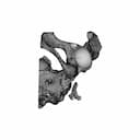 Hip Cavity Implant | 3D Engineering Design File_90_0_degree_snapshot