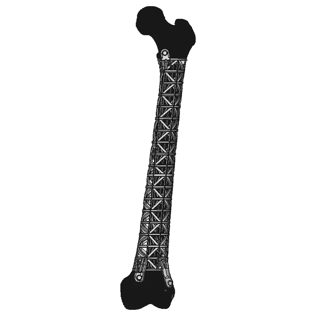 Individual Diaphyseal Femoral Implant On The Type Of Truss - Standard Mechanical Component_90_0_degree_snapshot